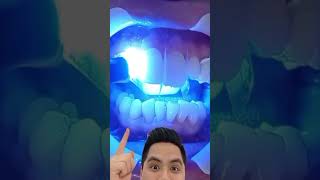 Carillas dentales de resina es tu mejor opción dientes dentista tips parati viral fyp [upl. by Prussian]