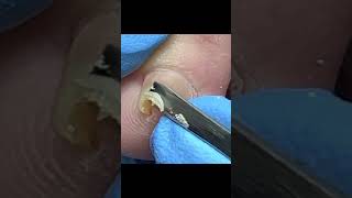 Satisfying pedicure video pedicure toenails [upl. by Schuster]