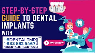 StepbyStep Guide to Dental Implants Start Your Journey at 18dentalimplantcom [upl. by Auhsoj]