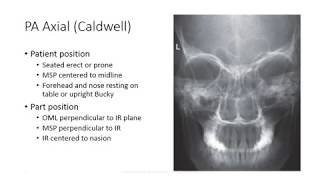 Radiographic Positioning of the Facial Bones [upl. by Llekram]