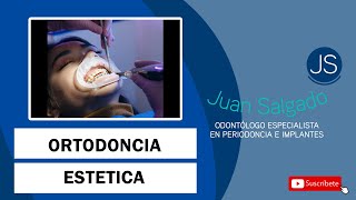 Ortodoncia estetica  Odontologia Practica [upl. by Adnoyek]