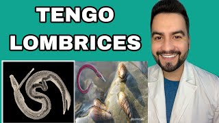 TENGO LOMBRICES  ESQUISTOSOMIASIS  DR DAVID CAMPOS [upl. by Lorne]