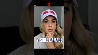 Laura Sanko  How Judges Score Damage in the UFC [upl. by Per]