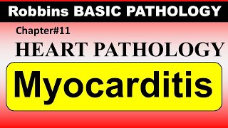 Chp11 Robbins Patho  Heart Pathology  Myocarditis  Dr Asif Lectures [upl. by Aliet]