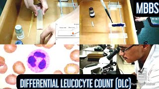 Differential Leucocyte Count DLC Practical  MUHS  mbbs physiology hematology [upl. by Eleaffar365]