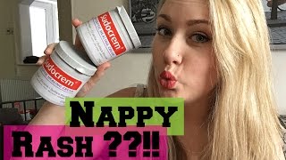 Sudocrem Review  Diaper Rash Spots Stretch Marks [upl. by Stephani]