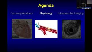 Annapoorna S Kini MD Coronary Anatomy Physiology and Imaging [upl. by Norvall]