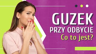 Masz GUZKI ANALNE 👉 Czy Guzki Przy Odbycie Są Groźne Sprawdź  Medycyna360 [upl. by Anaek]