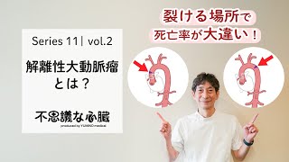 血管疾患編 vol2「解離性大動脈瘤とは？」【循環器専門医が解説】 [upl. by Eelir]