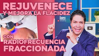 REJUVENECE Y MEJORA LA FLACIDEZ CON RADIOFRECUENCIA FRACCIONADA [upl. by Orr338]