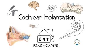 Cochlear Implantation FRCS ENT Exam Essentials [upl. by Arobed]