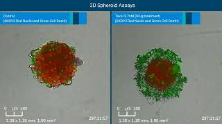 Monitoring and Quantifying 3D Tumor Spheroid Drug Cytotox by RTCA eSight Live Cell Analysis System [upl. by Minni]