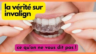 PERSONNE NEN PARLE  Invisalign [upl. by Letnohc]