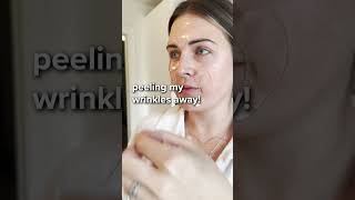 Peeling my wrinkles away with SoSmooth AntiWrinkle Patches [upl. by Akfir]