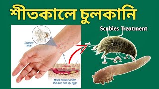 Scabies চুলকানির চিকিৎসা [upl. by Siuluj]