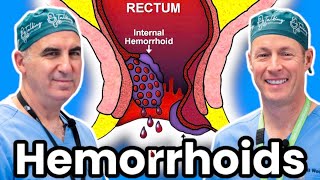 The Ultimate Treatment For Hemorrhoids [upl. by Virnelli]