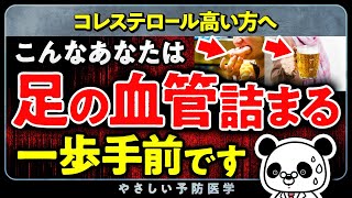 【要注意】動脈硬化が進行し足の血管が詰まるリスクが上昇している人の特徴５選（脂質異常症 コレステロール） [upl. by Aisyat45]