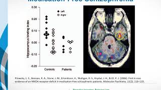 Causes of Schizophrenia Glutamate and the Glutamate Hypothesis [upl. by Adniral621]