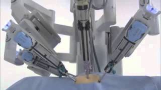 da Vinci® Surgery  How It Works [upl. by Ysset]