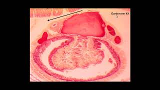 Earthworm Cross Section [upl. by Kingsbury]