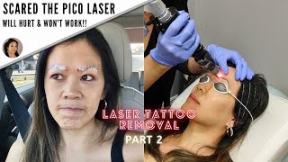 How I got my microblading removed Before amp AfterPart 2 [upl. by Berman]