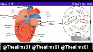 Endocarditis Cardiovascular diseasesdisorders [upl. by Erma]