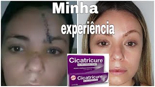 CICATRICURE FUNCIONA RESPONDENDO PERGUNTAS SOBRE MINHA EXPERIÊNCIAcicatriz cicatricure [upl. by Retepnhoj]