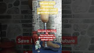 Best Below Knee Prosthesis Services 919910213766 Amputee Prosthesis Delhi [upl. by Corene882]