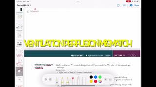 Ventilation Perfusion Ratio physiology Respiratory 17  First Aid USMLE Step 1 in UrduHindi [upl. by Icam]