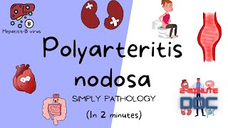 Polyarteritis nodosa Vasculitis  SimplyPathology  2minutedoc [upl. by Dloraj]