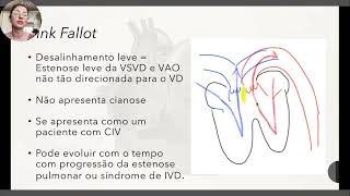 Tetralogia de Fallot  explicação completa [upl. by Dosh]