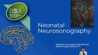 ASA 2022 Melbourne Conference  Neonatal Neurosonography [upl. by Aissela]