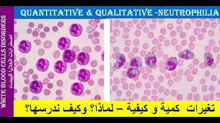 lecture 22 Neutrophilia Quantitative and Qualitative Changes [upl. by Emmuela]