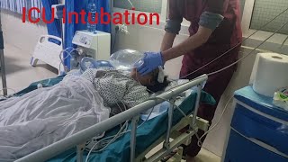 ICU Intubation How to inubate critical patient in ICU [upl. by Nare]