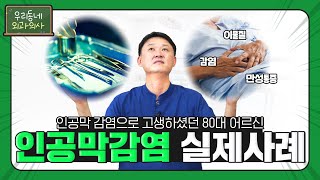 탈장병원 인공막 제거수술 어떻게 진행될까요 인공막감염 사례 [upl. by Ellenehc]