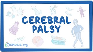 Cerebral palsy CP  causes symptoms diagnosis treatment pathology [upl. by Crary694]