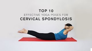 Top 10 Effective Yoga Poses for Cervical Spondylosis [upl. by Arraeic]