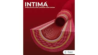 INTIMA Everolimus eluting coronary stent system [upl. by Maples]