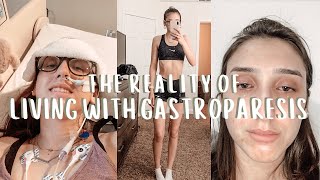 what suffering with gastroparesis is REALLY like  a look into the past 3 years [upl. by Malina576]