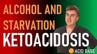 Alcoholic And Starvation Ketoacidosis [upl. by Cirtap]