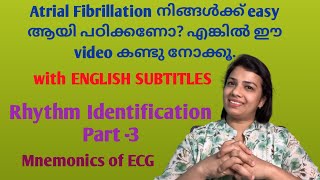 How to identity Atrial Fibrillation Easy way in malayalam for nursesRhythm Identification Part3 [upl. by Connell]