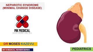 Nephrotic Syndrome Minimal Change Disease [upl. by Idihc866]