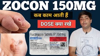 zocon 150  zocon 150 is used for in hindi  zocon 150 tablet  zocon 150 fluconazole [upl. by Sparhawk]