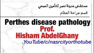 Perthes disease Pathology Prof Hisham AbdelGhany nasrcity online lectures 2020 [upl. by Shaddock]