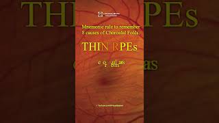 Choroidal Folds THIN RPEs Mnemonic rule to remember 8 causes [upl. by Yrtsed35]