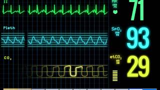 ECG Monitor Loop [upl. by Pontius]