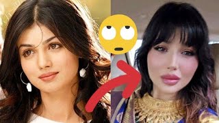 Ayesha Takia after plastic surgery 😟😲 [upl. by Maryly]