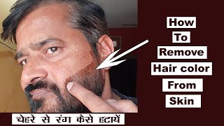 👩‍🦱💇‍♀️💦 How to Remove Hair ColorDye from Skin  चेहरे पर लगे हेयरडाय के निशान कैसे साफ करें 💄🚿 [upl. by Aikyt]