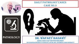 DAILY PATHOLOGY CASES CASE NO 9 Dr WAFAEY BADAWY [upl. by Roach590]