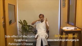 Dyskinesia in Parkinsons Disease [upl. by Gwyn]